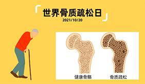 骨質疏松與年輕人無關？這6個誤區了解一下！
