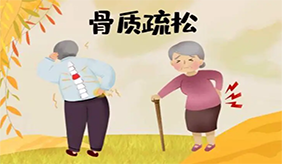 一分鐘測試骨質疏松，你是“骨脆脆”嗎？