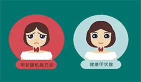 甲亢和甲減到底怎么區(qū)分
