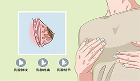 乳腺癌早期有信號，除了無痛腫塊，還需留意5種異常