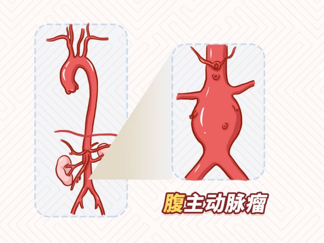 下載 (2)